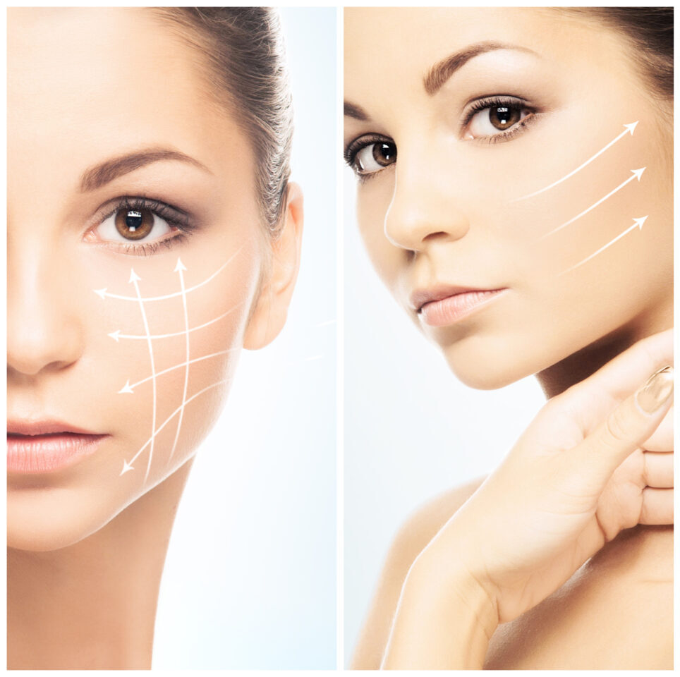 Collage of female portraits. Healthy faces of young women. Spa, face lifting, plastic surgery concept.